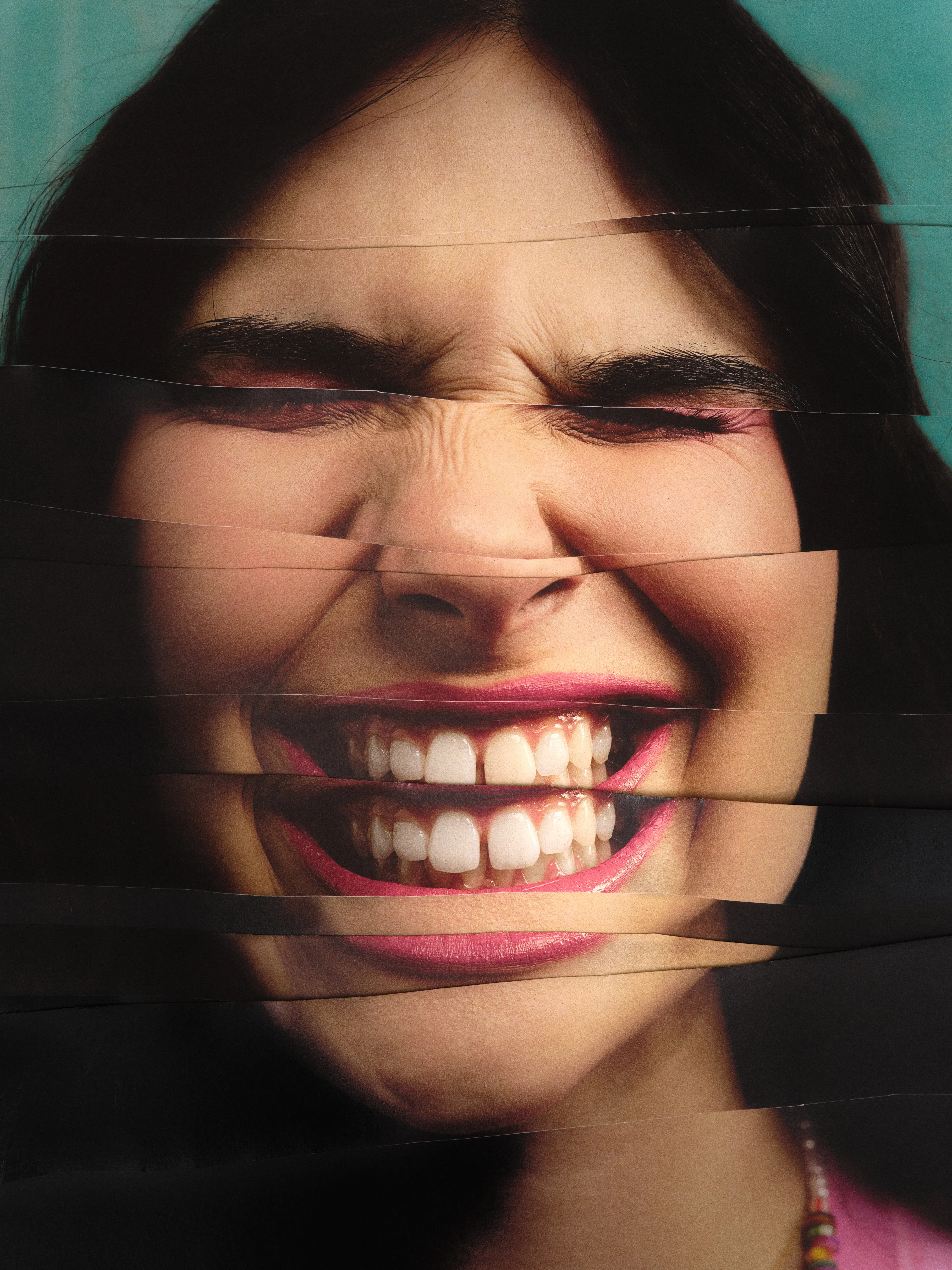 Sorriso saudável em destaque, resultado de ortodontia invisível