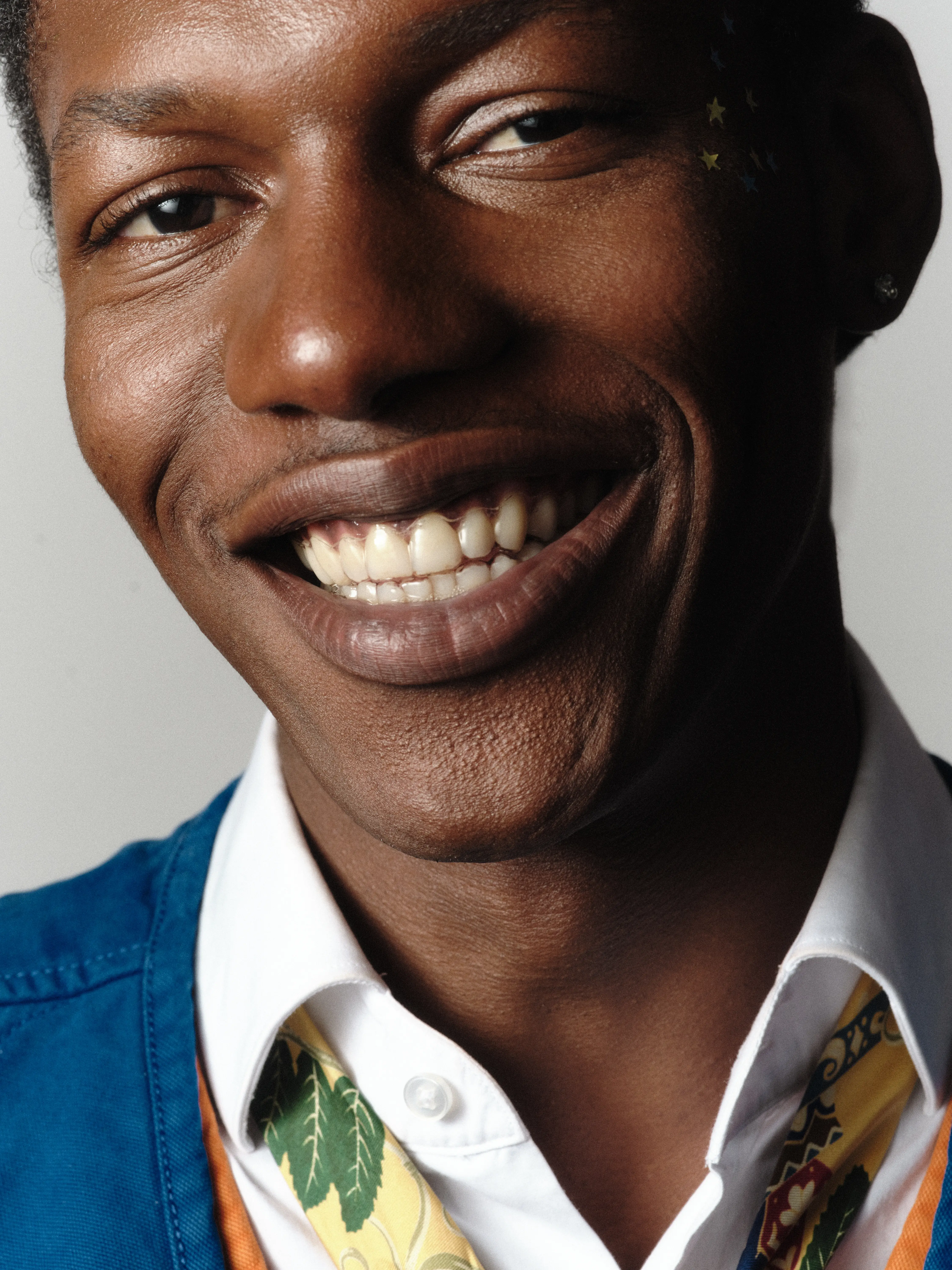 Homem com sorriso harmonioso e aparelho transparente removível